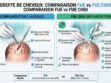 Greffe FUE et CHOI Est-ce le même chirurgien